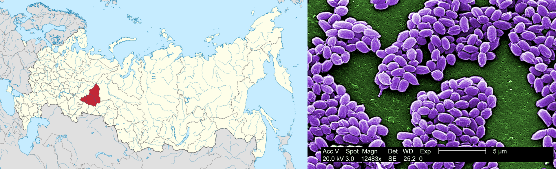 Map showing Sverdlovsk, in Union of Soviet Socialist Republics (USSR) and image of bacillus anthracis spores