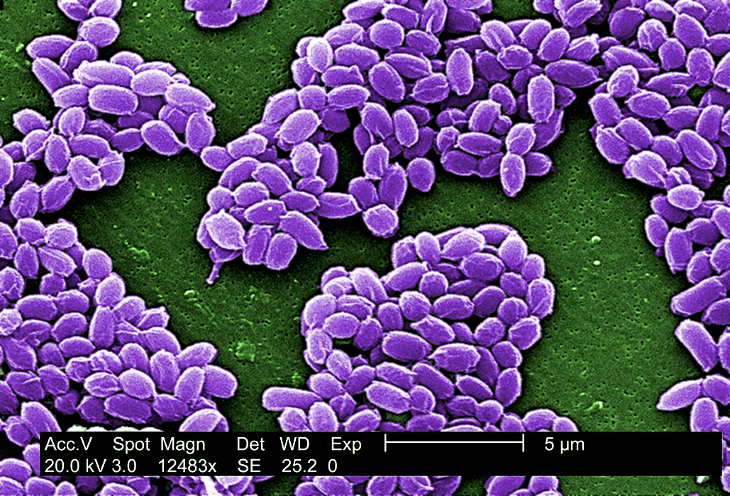 bacillus antracis spores