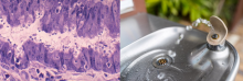 Figure 25: Organisms such as Cryptosporidium parasites can be introduced into the intestinal system by unsafe water sources